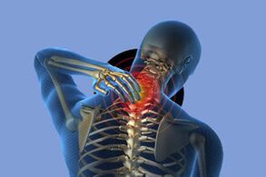 Các triệu chứng của bệnh xương khớp cổ tử cung