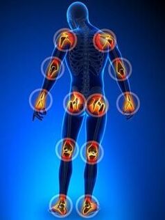 Nội địa hóa các khớp bị ảnh hưởng bởi bệnh viêm khớp
