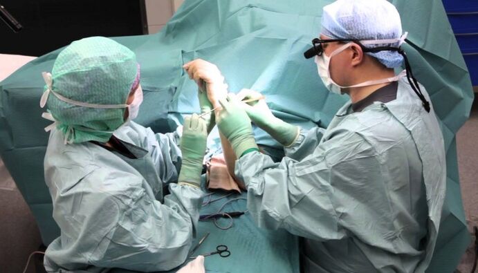 phẫu thuật điều trị đau ở khớp ngón tay