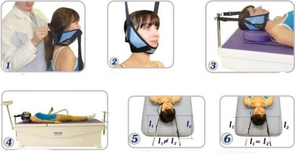 điều trị thoái hóa đốt sống cổ bằng phương pháp kéo