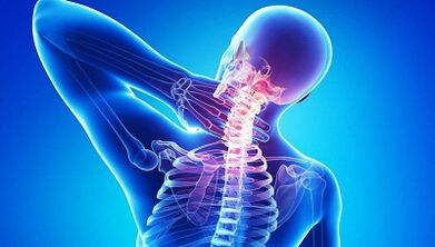 Bệnh thoái hóa xương khớp biểu hiện như thế nào
