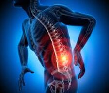 các nguyên nhân khác nhau của đau lưng