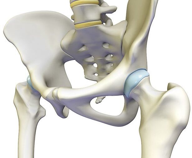 Chứng u xương gây ra cơn đau buốt ở khớp háng