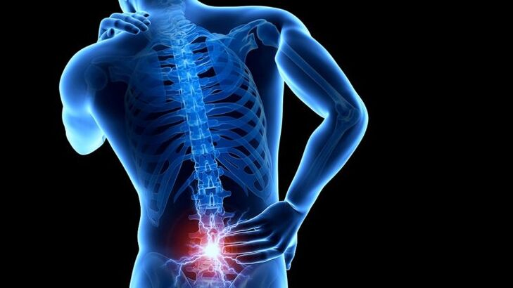 đau lưng kèm thoái hóa đốt sống thắt lưng